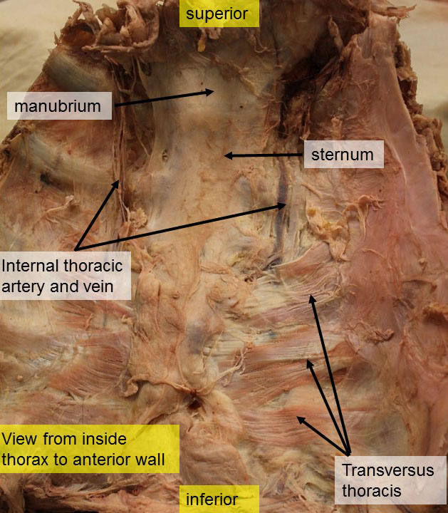 internal thoracic artery cadaver